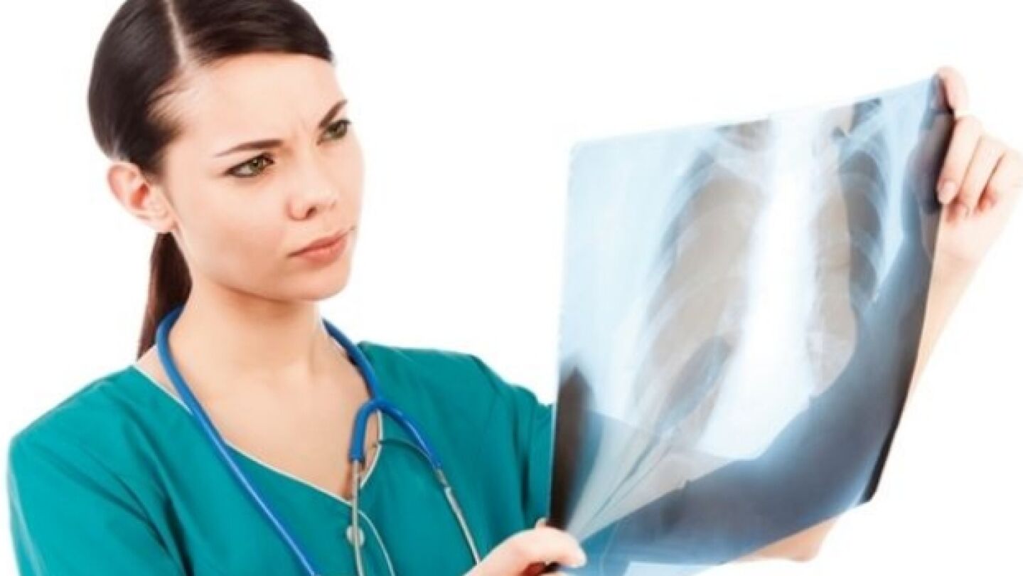 EL c&aacute;ncer de pulm&oacute;n