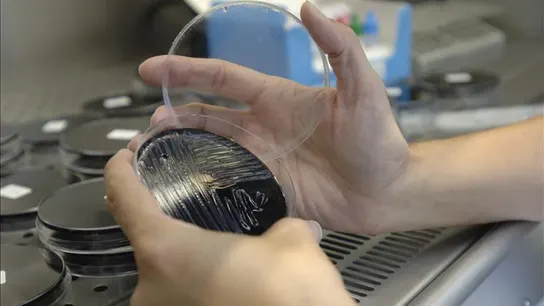 El brote de legionella de Ciudad Real afecta a 41 personas El brote de legionella de Ciudad Real afecta a 41 personas