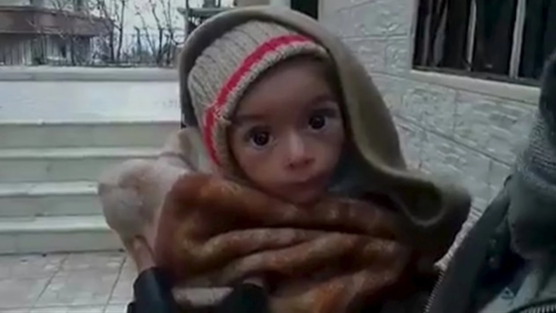 Bebé desnutrido en la ciudad de Madaya