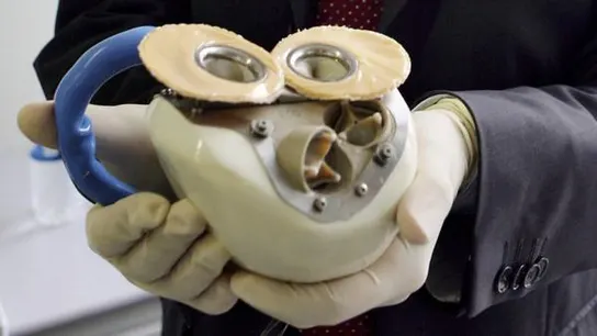 Interior de un corazón artificial Interior de un corazón artificial