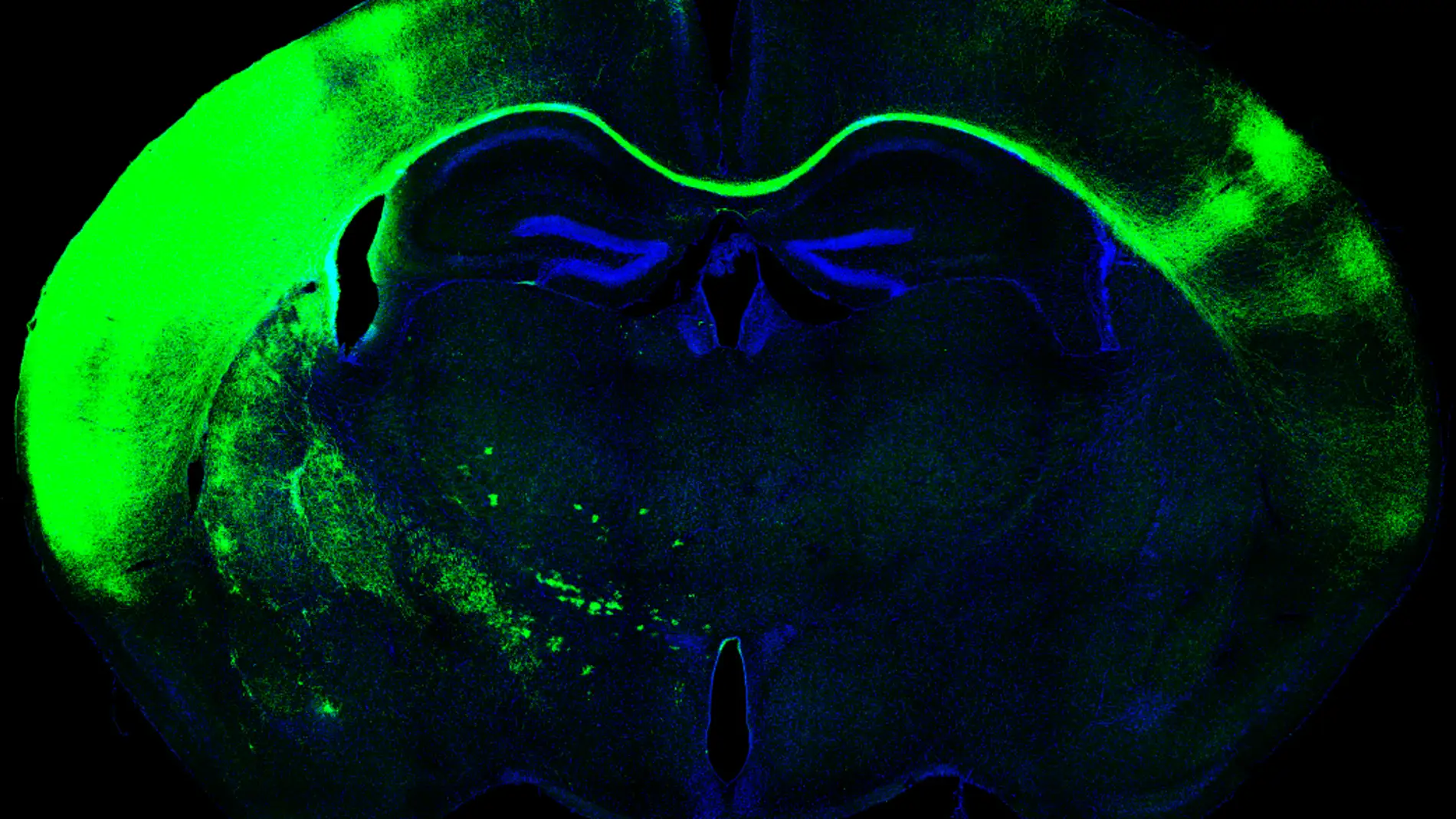 Cerebro de ratón, cuerpo calloso