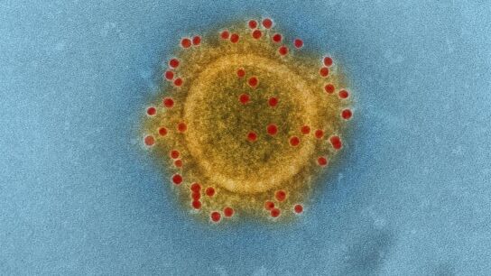 Imagen microsc&oacute;pica del virus MERS - CoV 