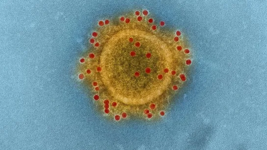 Imagen microscópica del virus MERS - CoV Imagen microscópica del virus MERS - CoV
