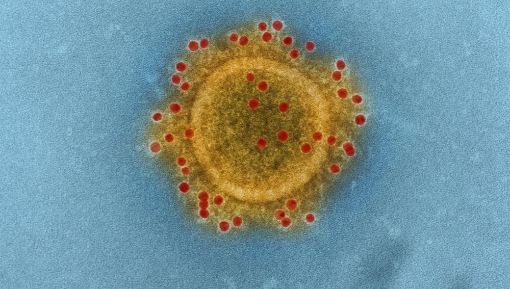 Imagen microscópica del virus MERS - CoV 