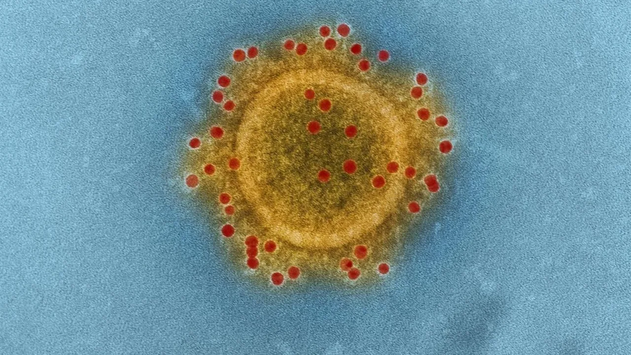 Imagen microscópica del virus MERS - CoV Imagen microscópica del virus MERS - CoV