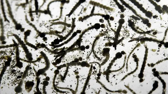Un laboratorio de larvas del mosquito Aedes Aegypti, transmisor del virus del Zika. Un laboratorio de larvas del mosquito Aedes Aegypti, transmisor del virus del Zika.