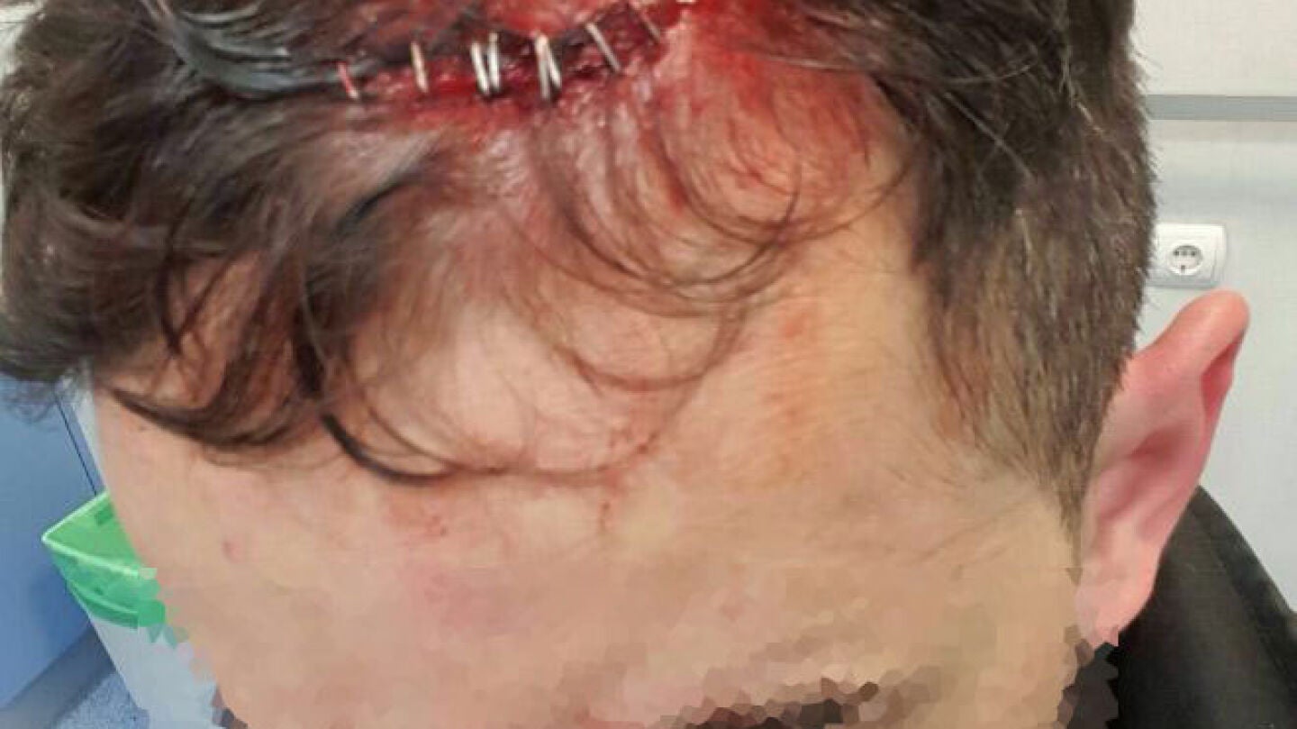 Trece polic&iacute;as heridos, tres de ellos graves, tras ser agredidos en Madrid