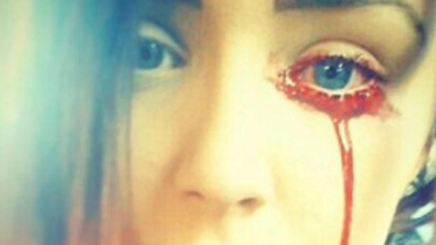 Imagen de la joven sangrando por un ojo Imagen de la joven sangrando por un ojo