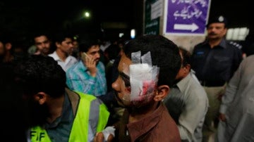 Víctima del atentado en Pakistán