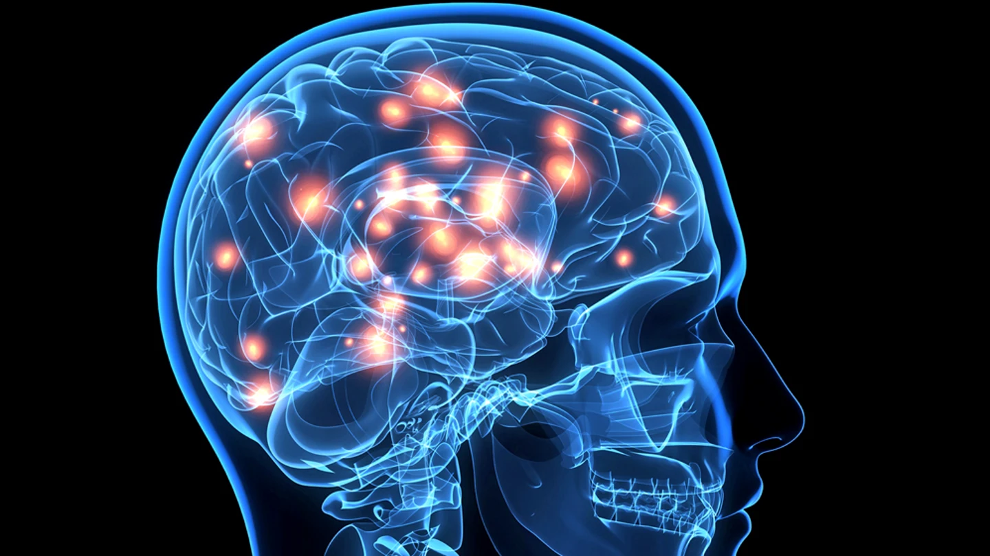 Cerebro Cerebro