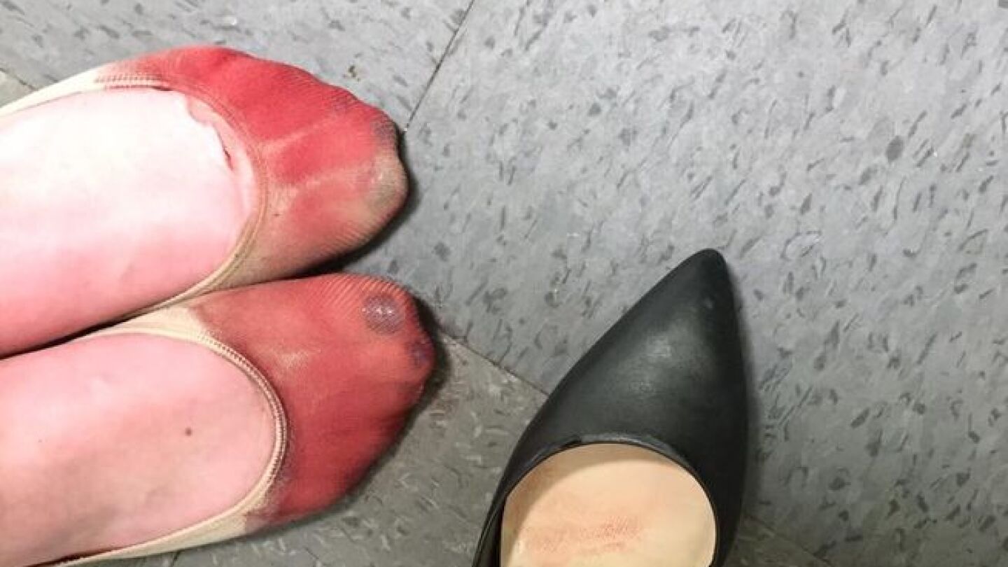 Pies por usar mucho tiempo tacones