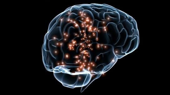 Recreaci&oacute;n cerebro 