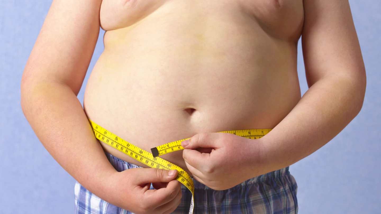 Imagen de una persona obesa Imagen de una persona obesa