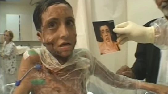 Zubaida mientras recibía el tratamiento Zubaida mientras recibía el tratamiento