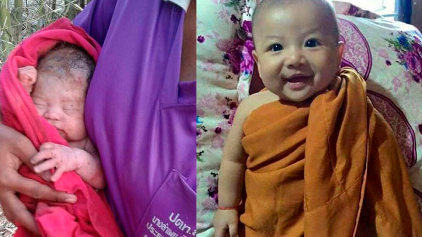 El antes y el despu&eacute;s del beb&eacute; enterrado vivo en Tailandia