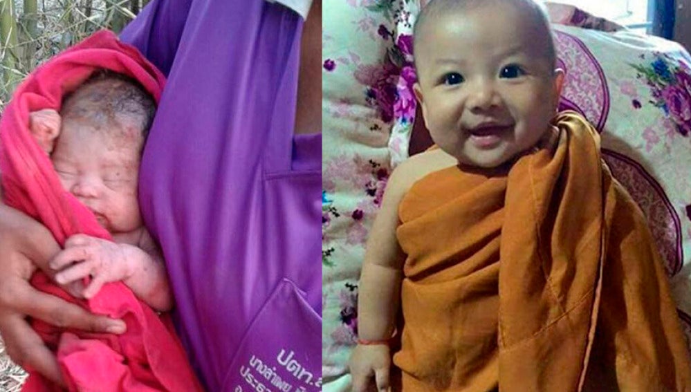 El antes y el después del bebé enterrado vivo en Tailandia