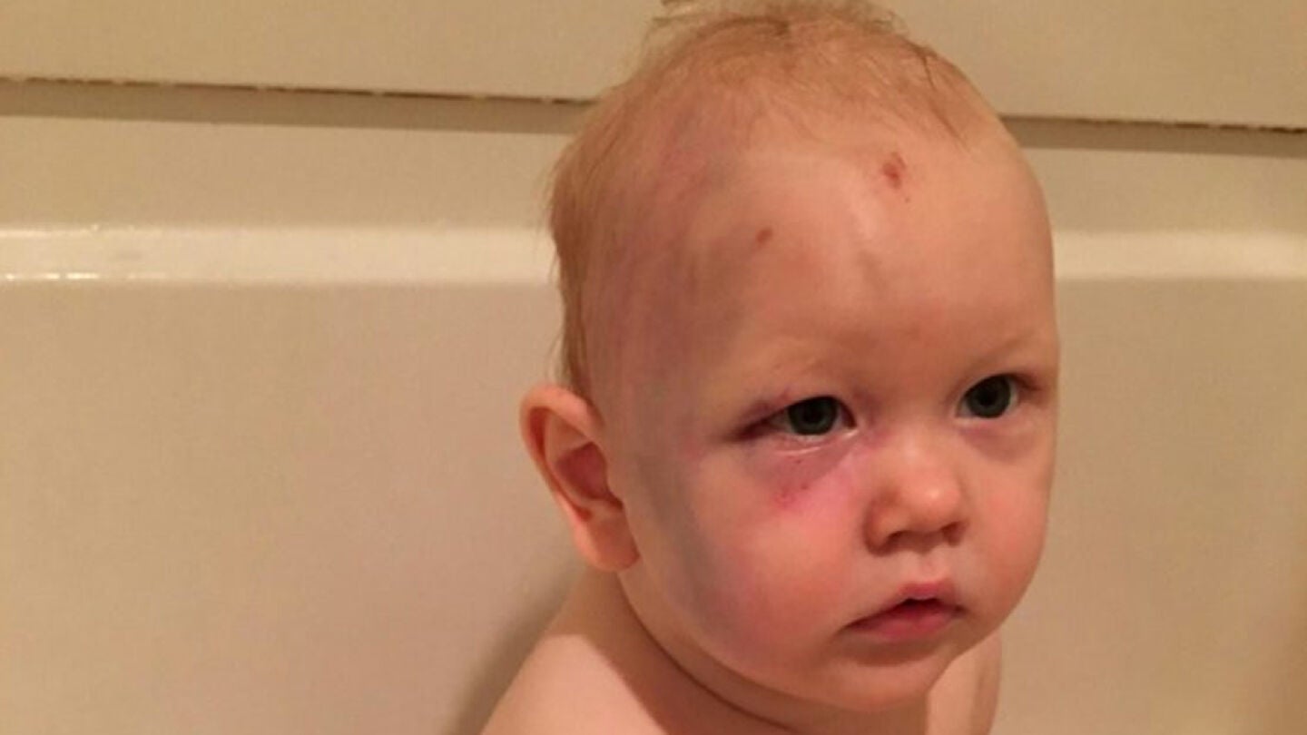 Ni&ntilde;o Agredido en EEUU