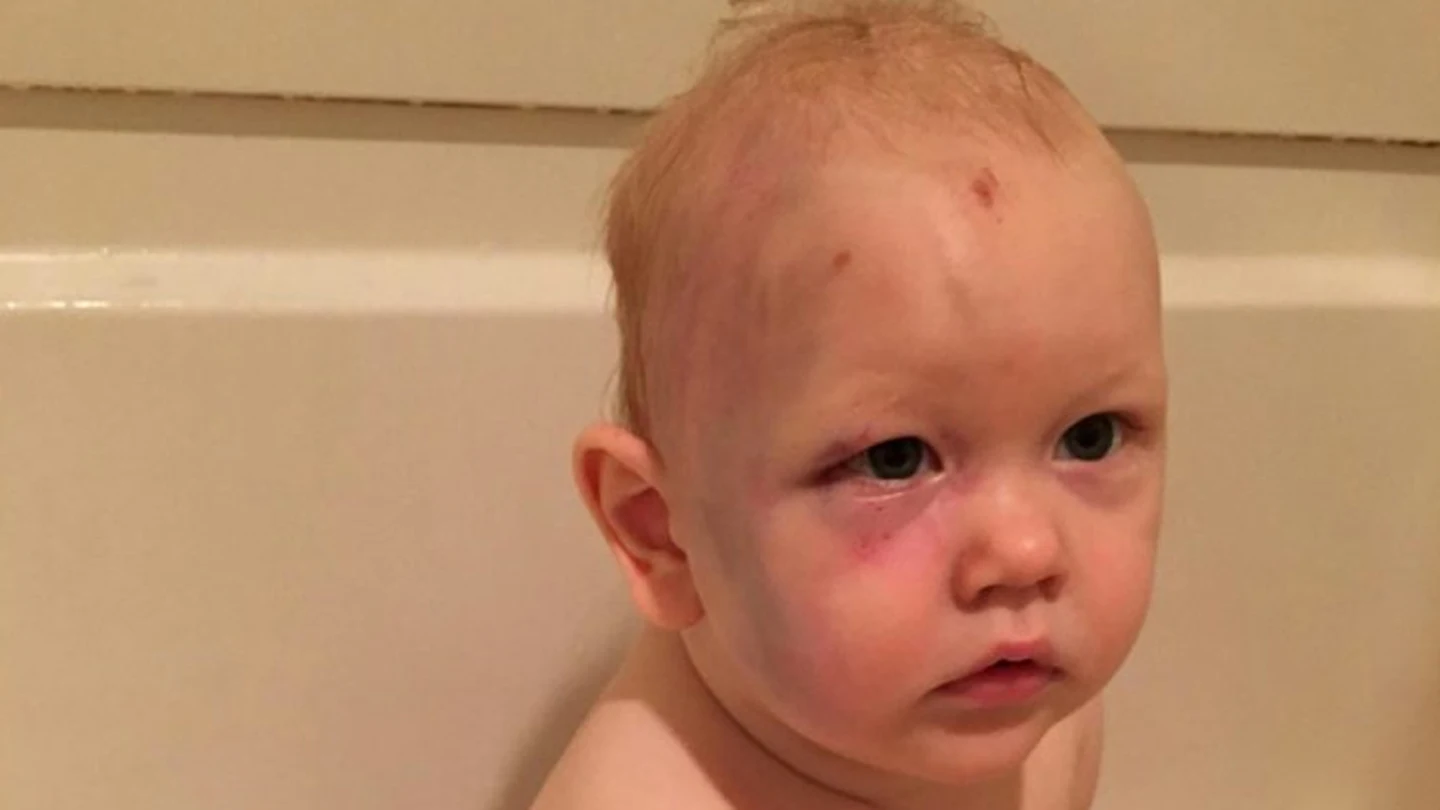 Niño Agredido en EEUU Niño Agredido en EEUU
