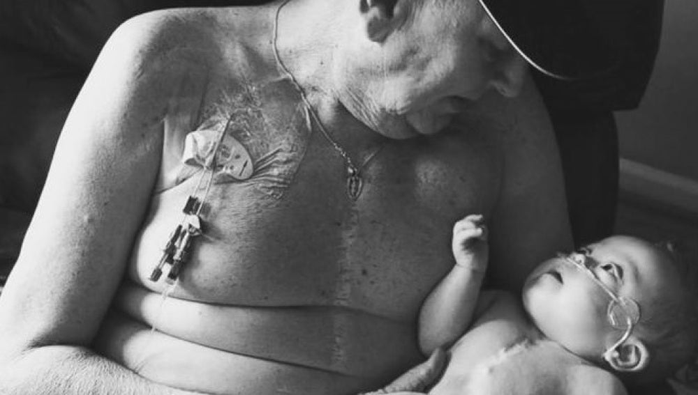 El abuelo junto a su nieto tras la operación a corazón abierto