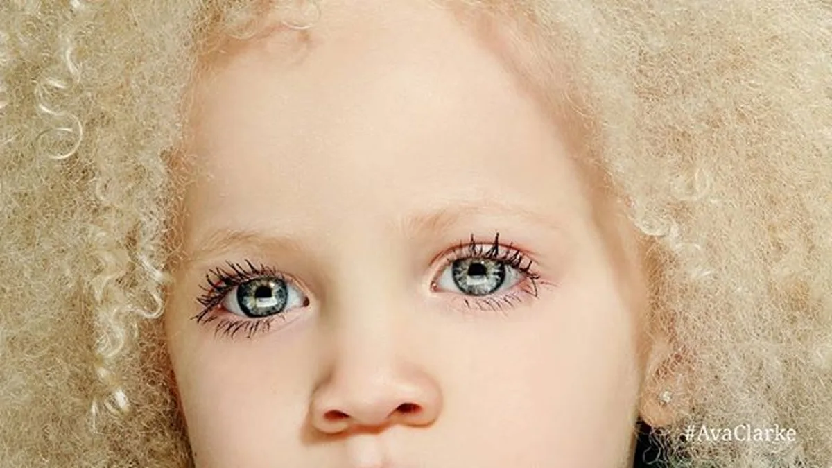 Una niña albina de raza negra revoluciona el mundo de la moda y arrasa en  las redes sociales