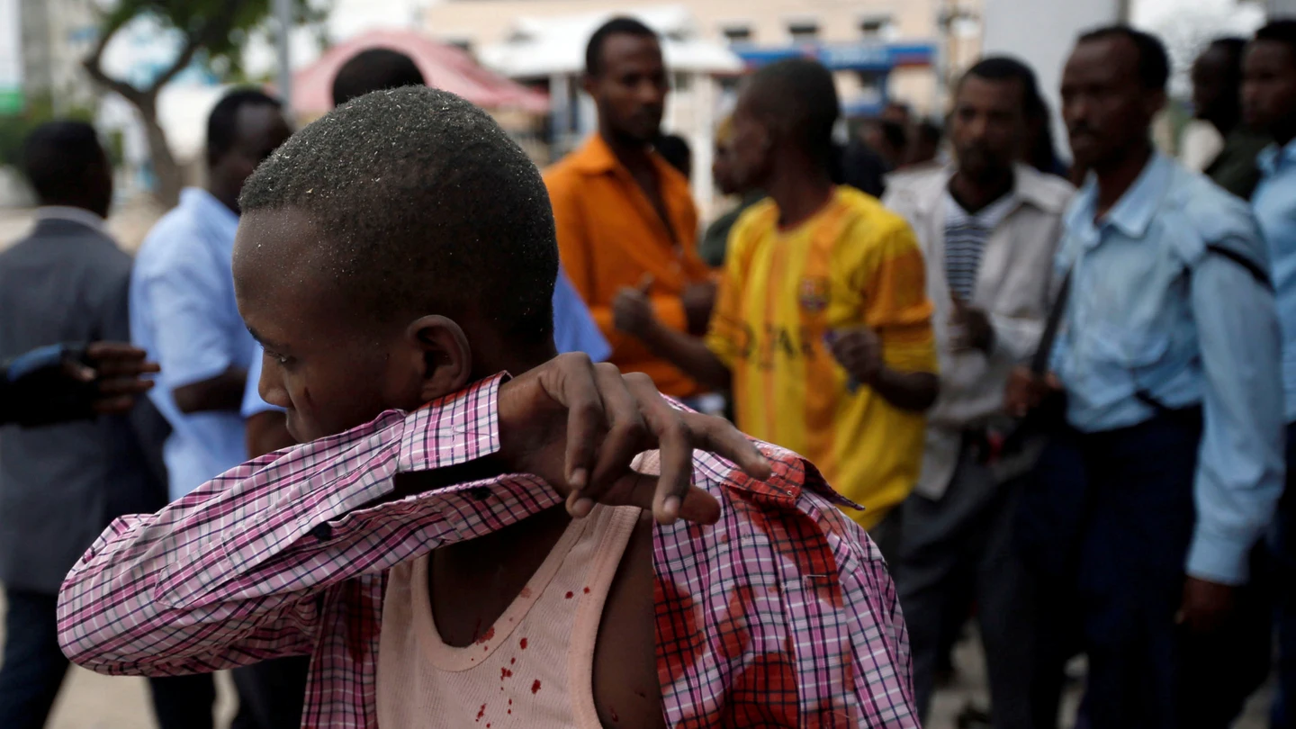 Heridos en el ataque terrorista en Mogadiscio Heridos en el ataque terrorista en Mogadiscio