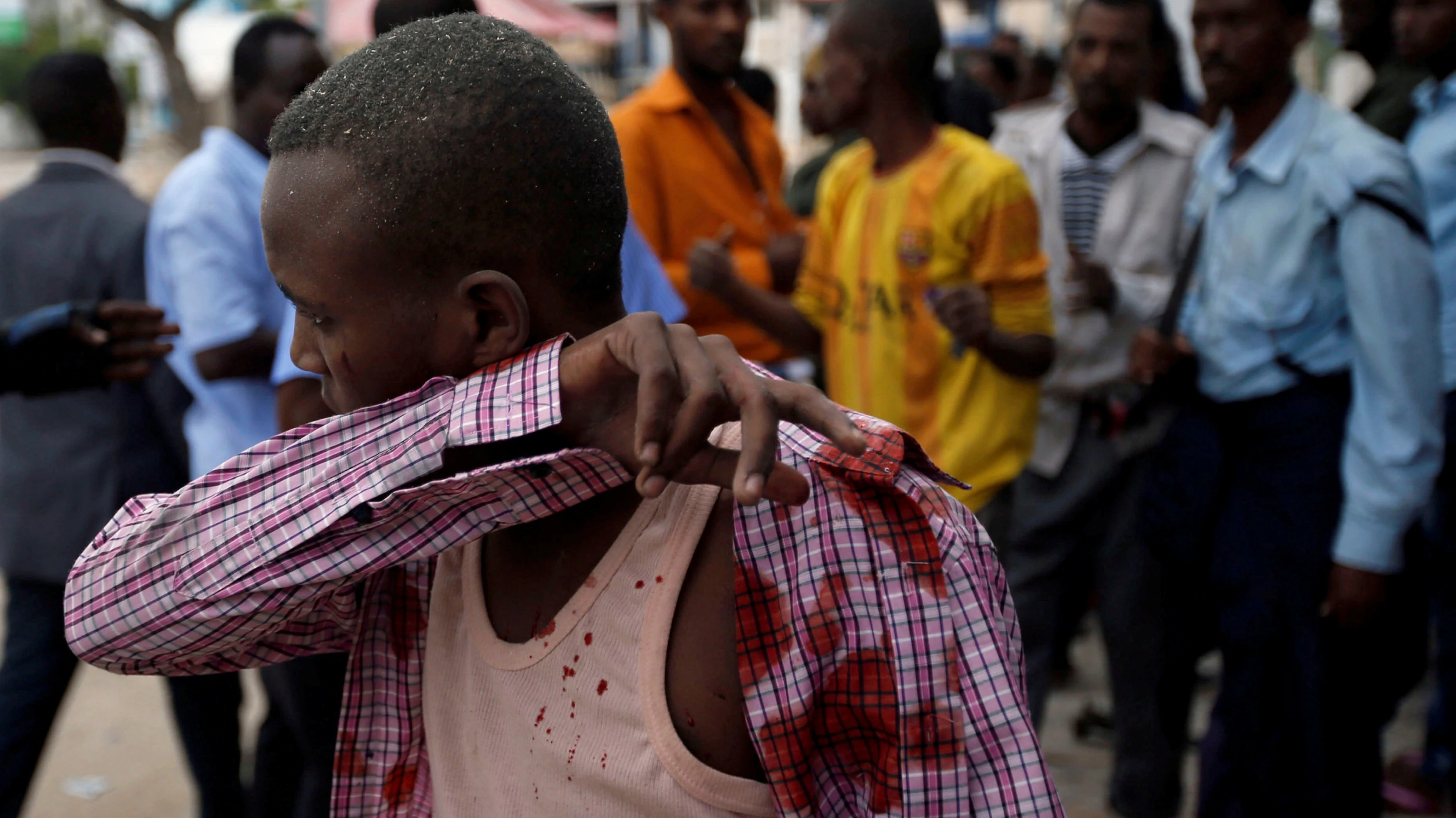 Heridos en el ataque terrorista en Mogadiscio