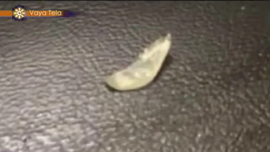 La 'supuesta uña' de Justin Bieber La 'supuesta uña' de Justin Bieber