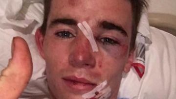  Un joven se rompe la nariz y la ambulancia le atropella una pierna cuando acude a socorrerlo