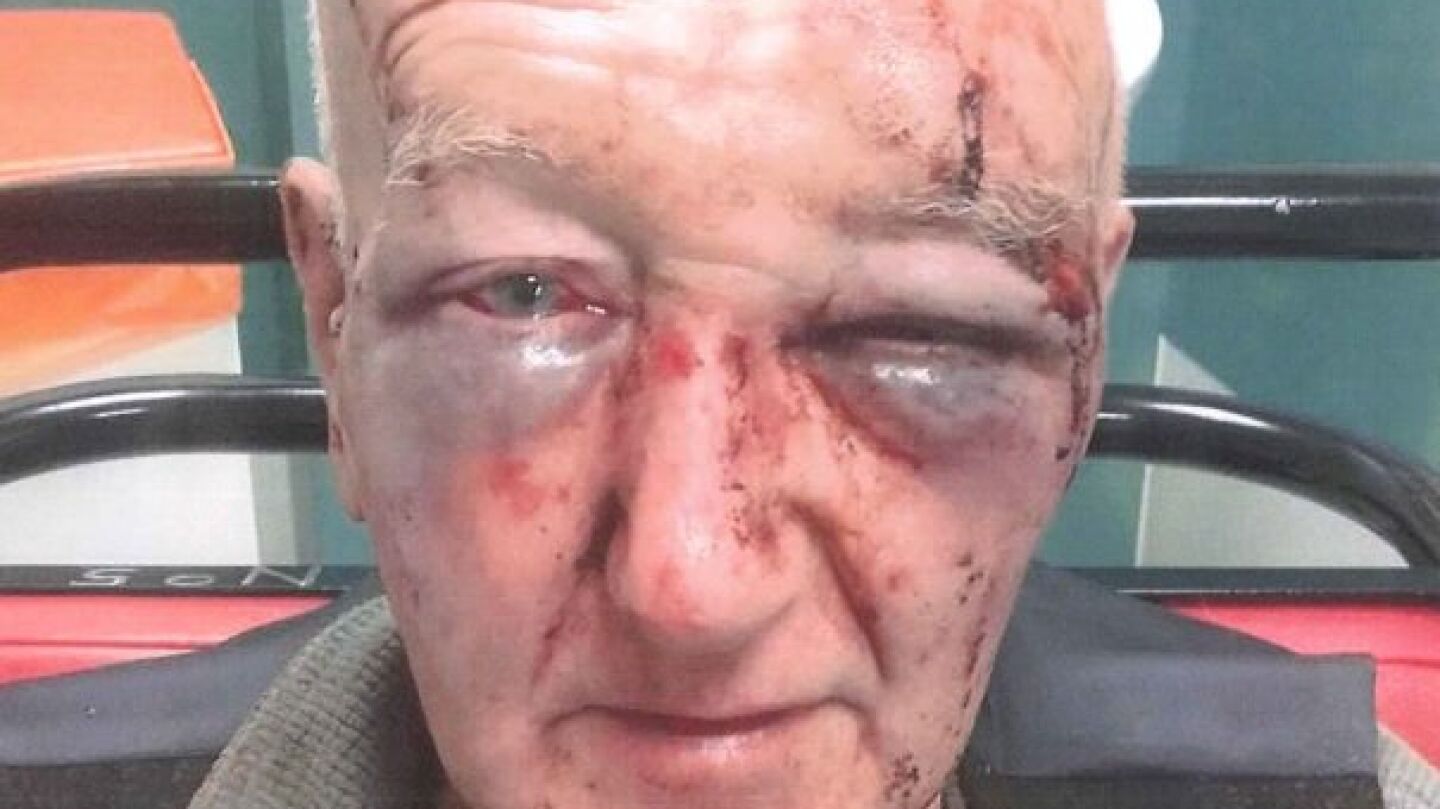 Derek Laidlaw, tras haber sido agredido brutalmente