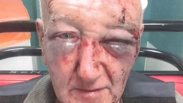 Derek Laidlaw, tras haber sido agredido brutalmente Derek Laidlaw, tras haber sido agredido brutalmente