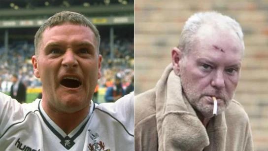El antes y el después de Paul Gascoigne El antes y el después de Paul Gascoigne