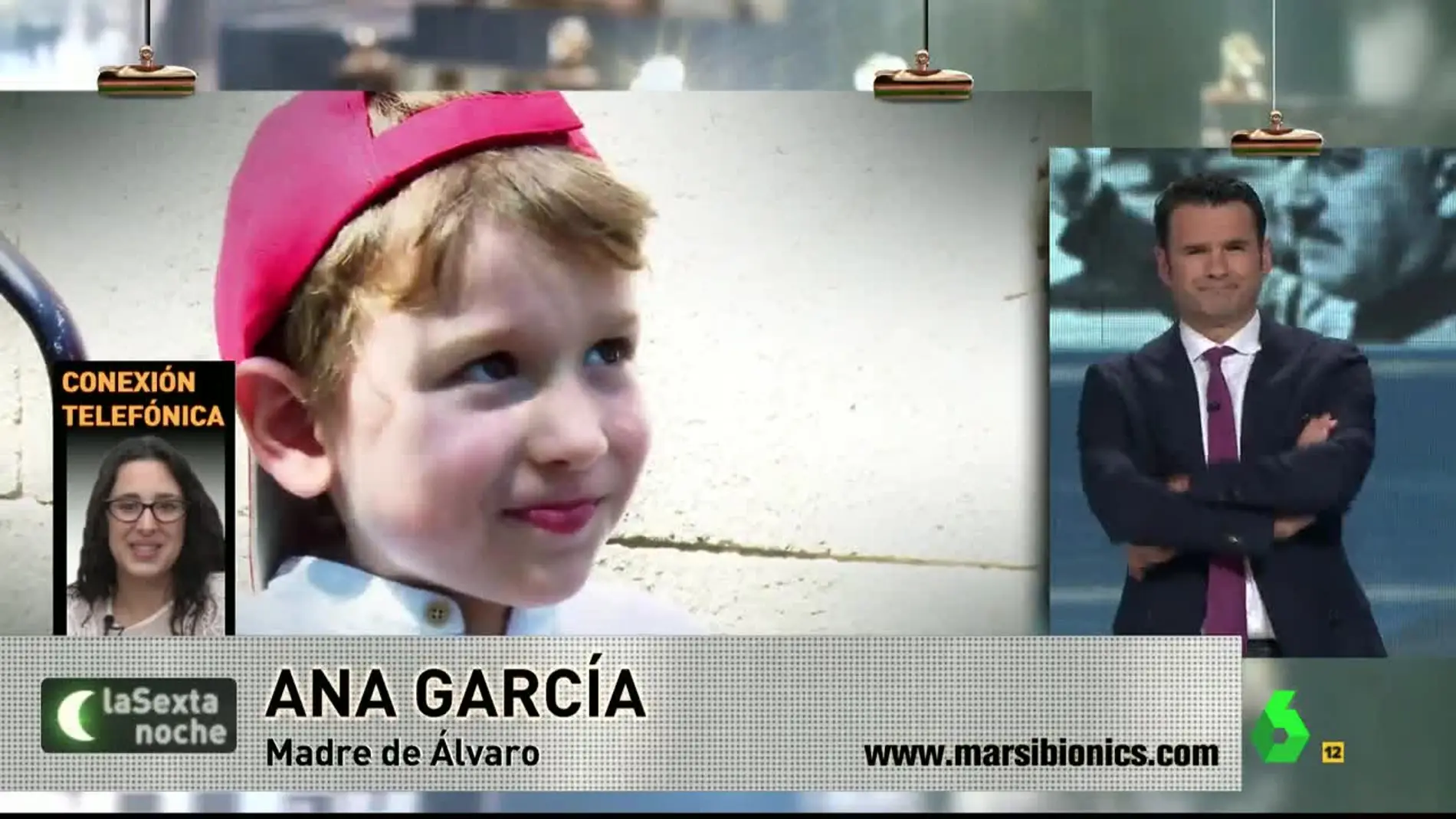 Ana García, madre de un menor que necesita exoesqueleto