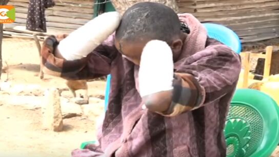 Jackline Mwende muestra las heridas que le ha infligido su marido en Kenia