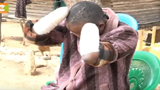 Jackline Mwende muestra las heridas que le ha infligido su marido en Kenia Jackline Mwende muestra las heridas que le ha infligido su marido en Kenia