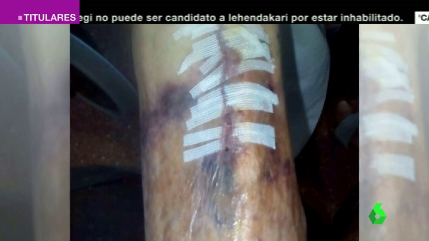 Frame 37.690248 de: Denuncian agresiones a los ancianos en una residencia de San Sebasti&aacute;n de los Reyes: "No tienen humanidad"