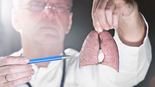 Un inhalador triplica la supervivencia en un tipo de cáncer de pulmón Un inhalador triplica la supervivencia en un tipo de cáncer de pulmón