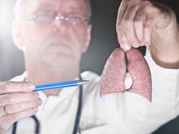 Un inhalador triplica la supervivencia en un tipo de cáncer de pulmón Un inhalador triplica la supervivencia en un tipo de cáncer de pulmón