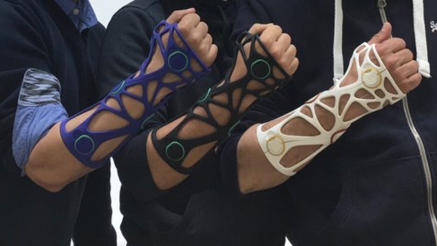 Xkelet, el invento espa&ntilde;ol que cambiar&aacute; la traumatolog&iacute;a
