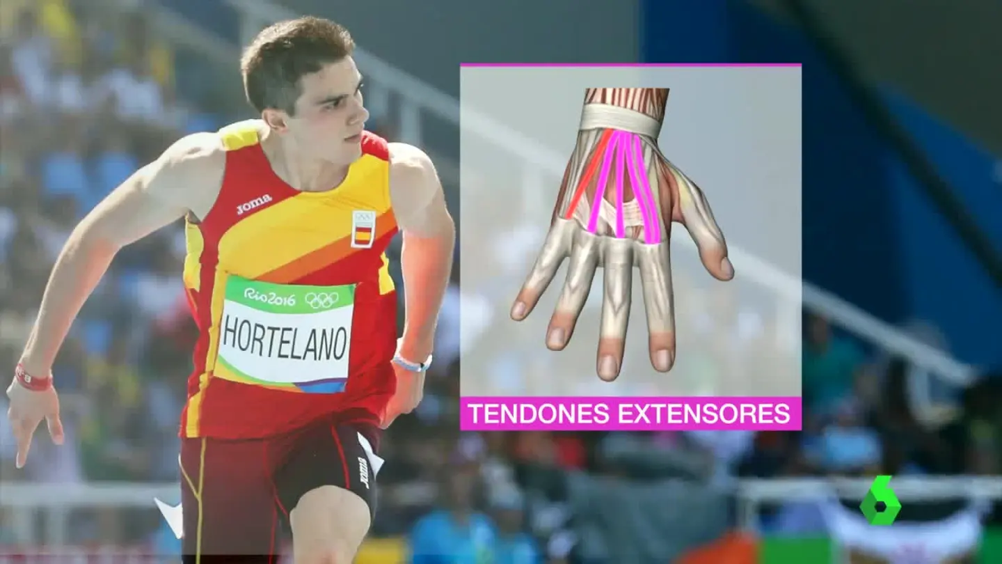 Bruno Hortelano, operado de los tendones extensores Bruno Hortelano, operado de los tendones extensores