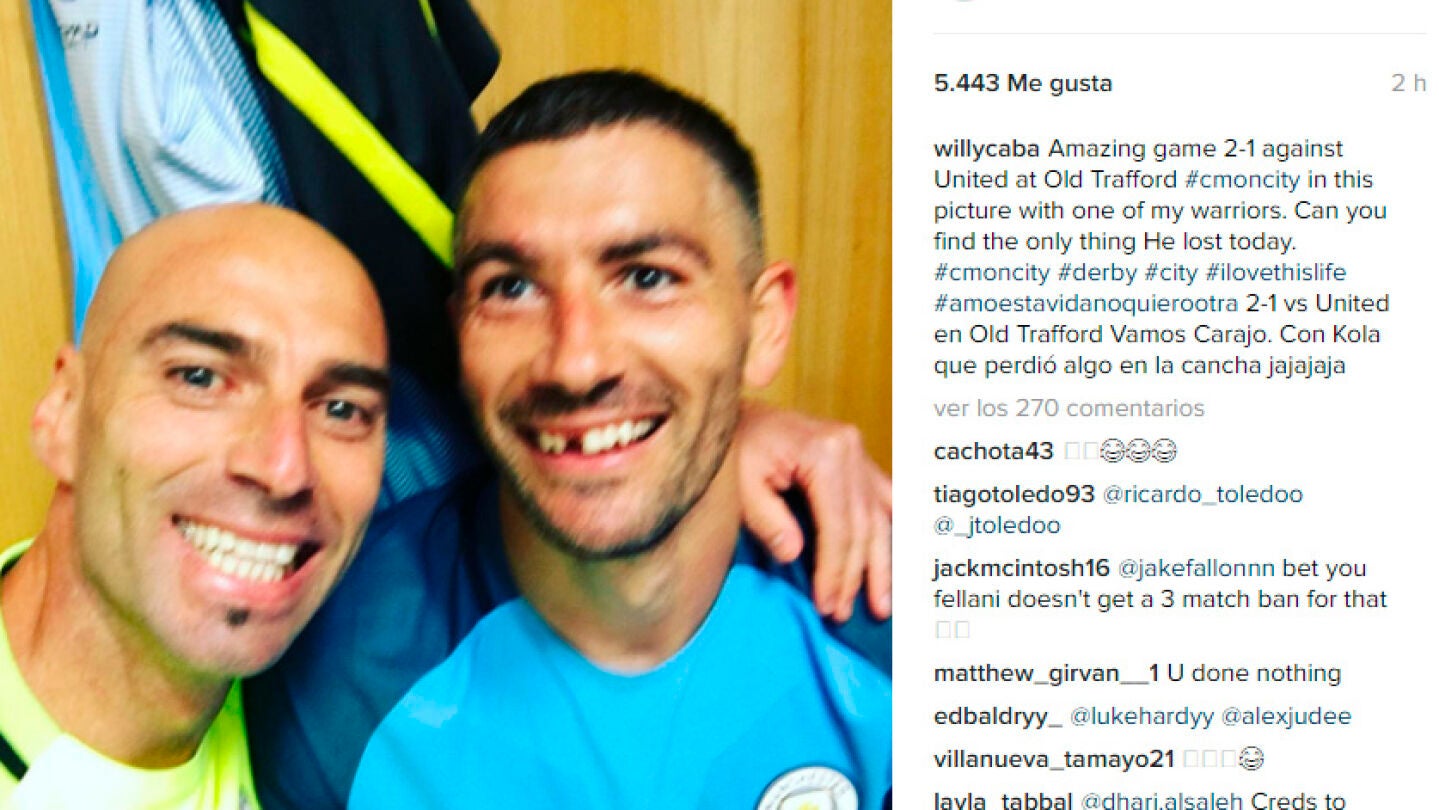 Willy Caballero bromeando sobre el diente de Kolarov