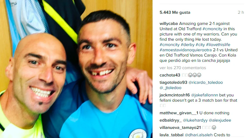 Willy Caballero bromeando sobre el diente de Kolarov