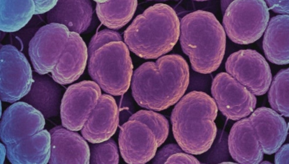 Bacteria que provoca la gonorrea