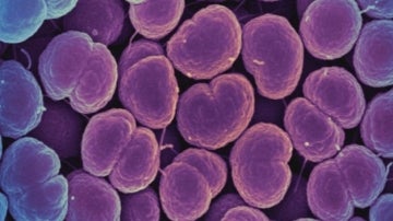Neisseria gonorrhoeae, la bacteria que provoca la gonorrea