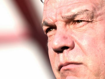 Allardyce Allardyce