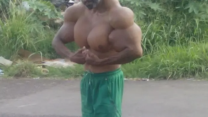 Valdir Segato, el hombre que se inyecta aceite para que sus bíceps crezcan Valdir Segato, el hombre que se inyecta aceite para que sus bíceps crezcan