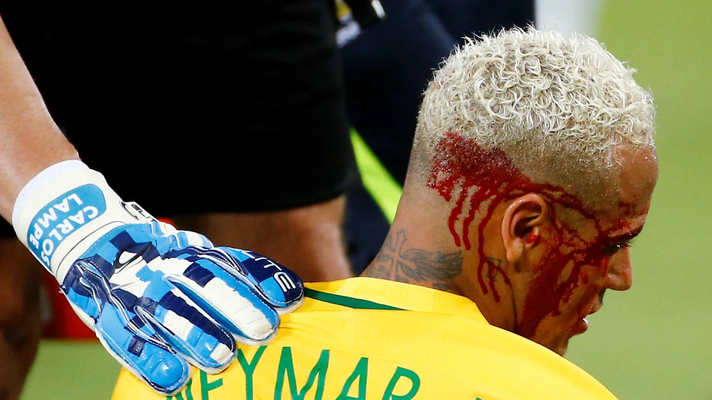 Neymar, con el rostro ensangrentado tras recibir un codazo Neymar, con el rostro ensangrentado tras recibir un codazo