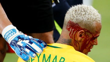 Neymar, con el rostro ensangrentado tras recibir un codazo