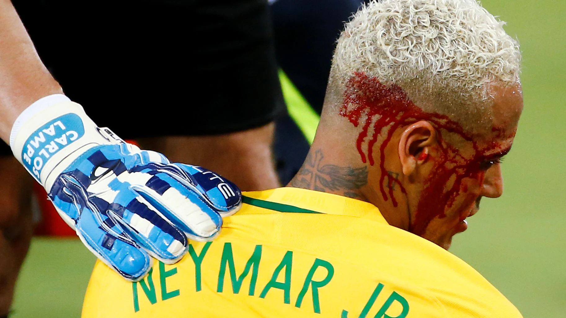 Neymar, con el rostro ensangrentado tras recibir un codazo