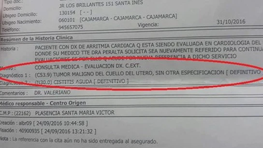 Diagnostico erróneo de un anciano en perú Diagnostico erróneo de un anciano en perú