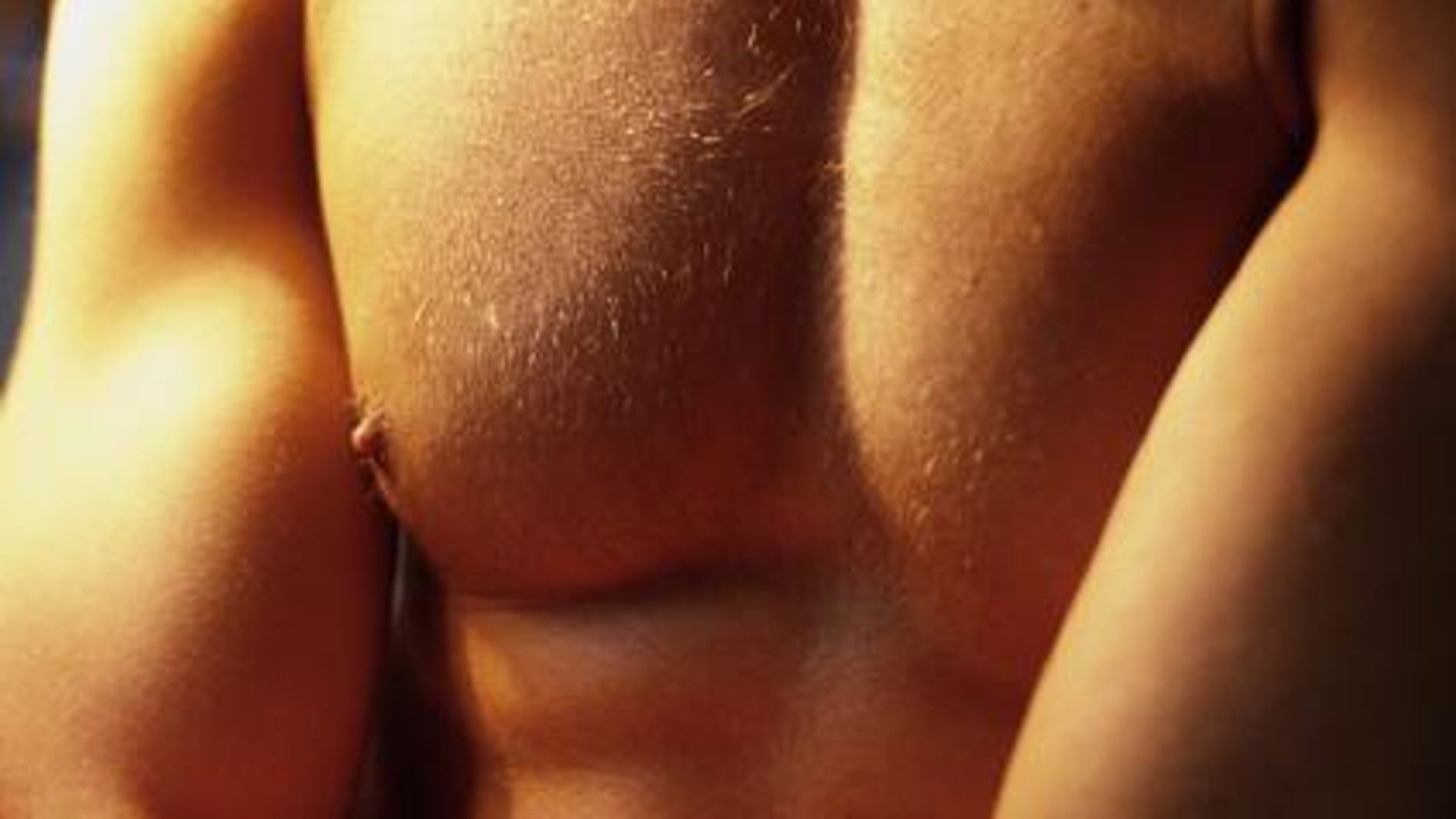 El cáncer de mama masculino tiene una incidencia del 1%